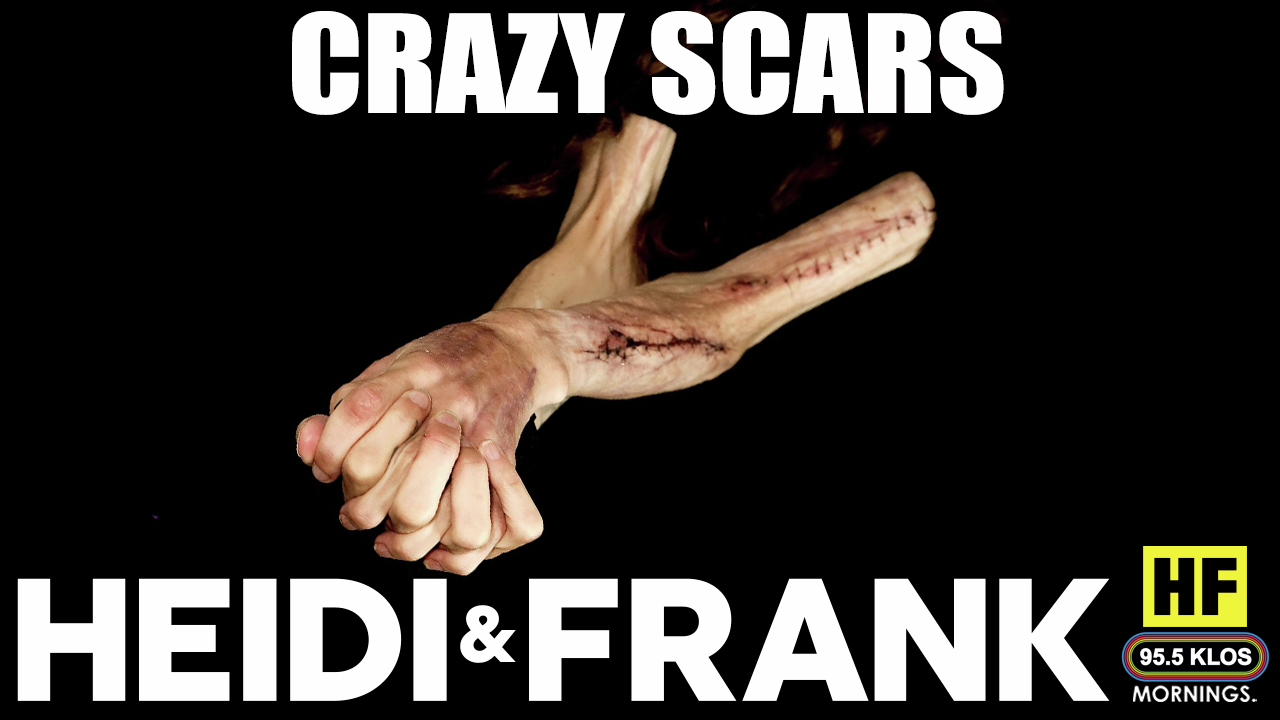 Crazy Scars