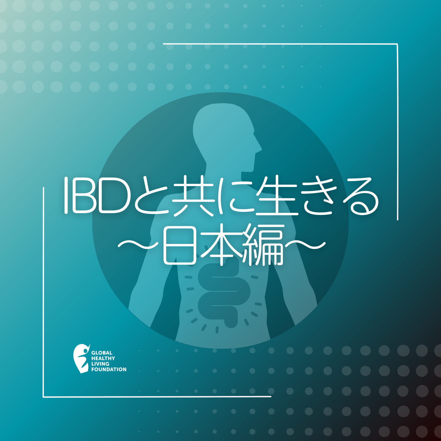 IBDと共に生きる〜日本編〜