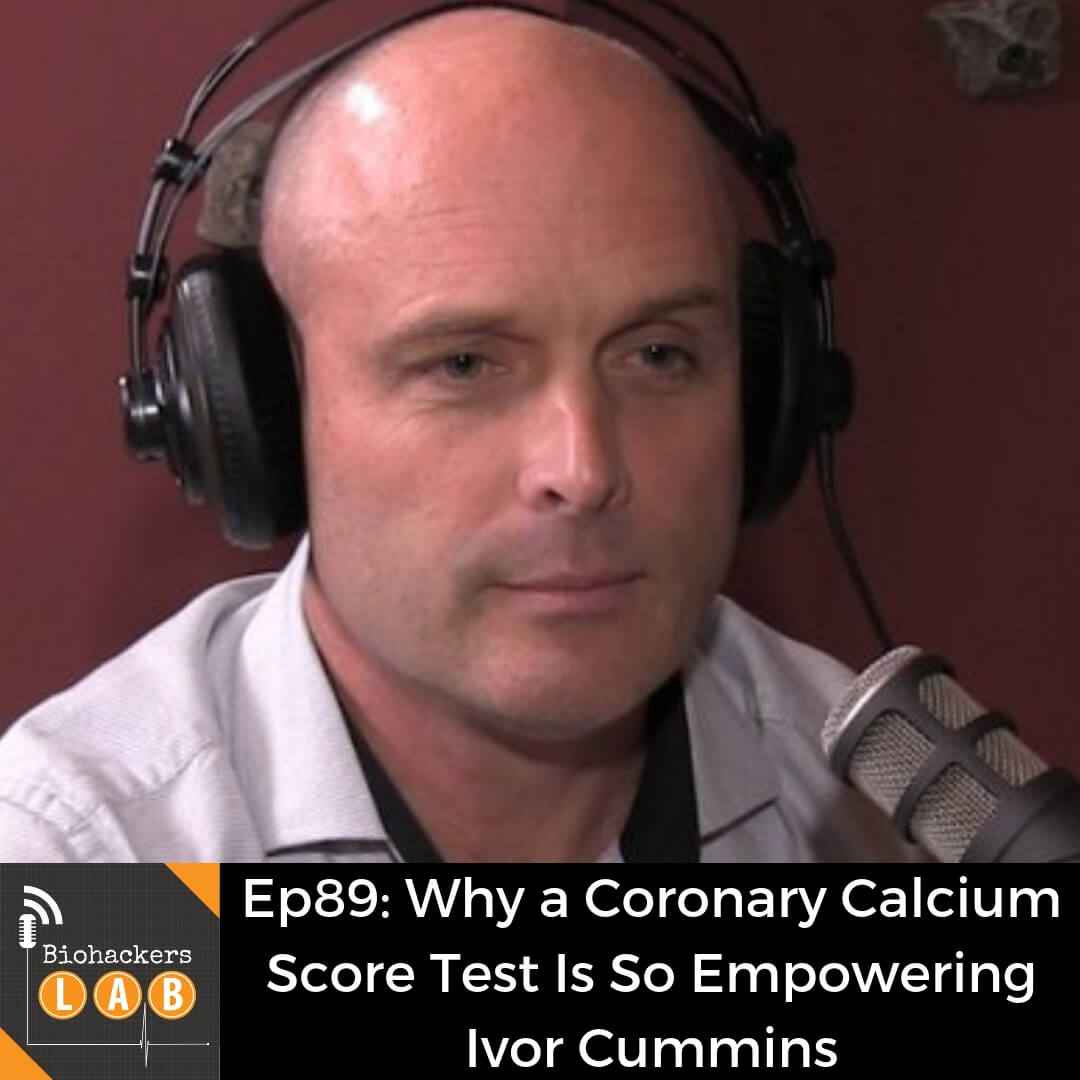 Why a Coronary Calcium Score Test Is So Empowering • Ivor Cummins