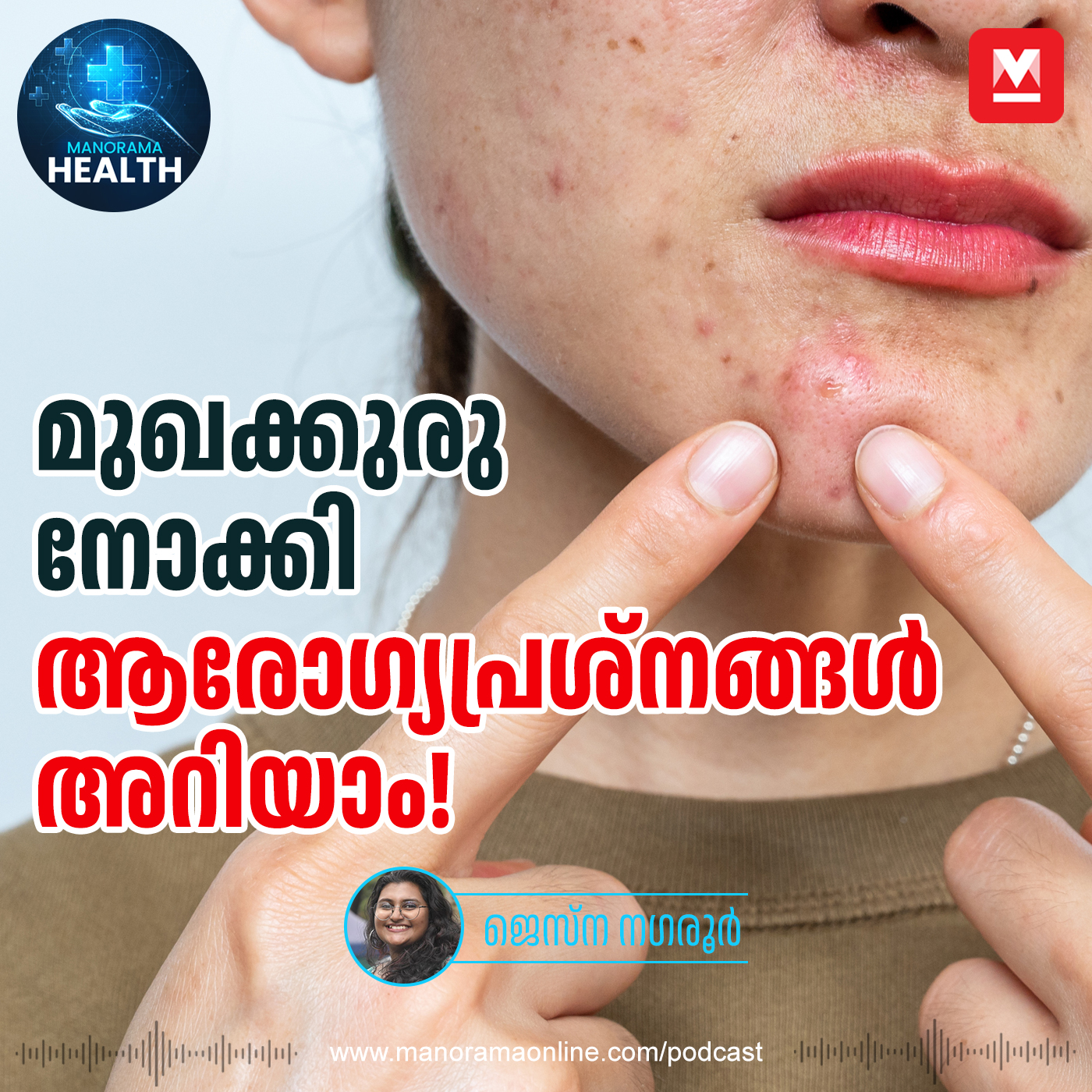 മുഖക്കുരുവിന്റെ സ്ഥാനം നോക്കി രോഗം അറിയാം