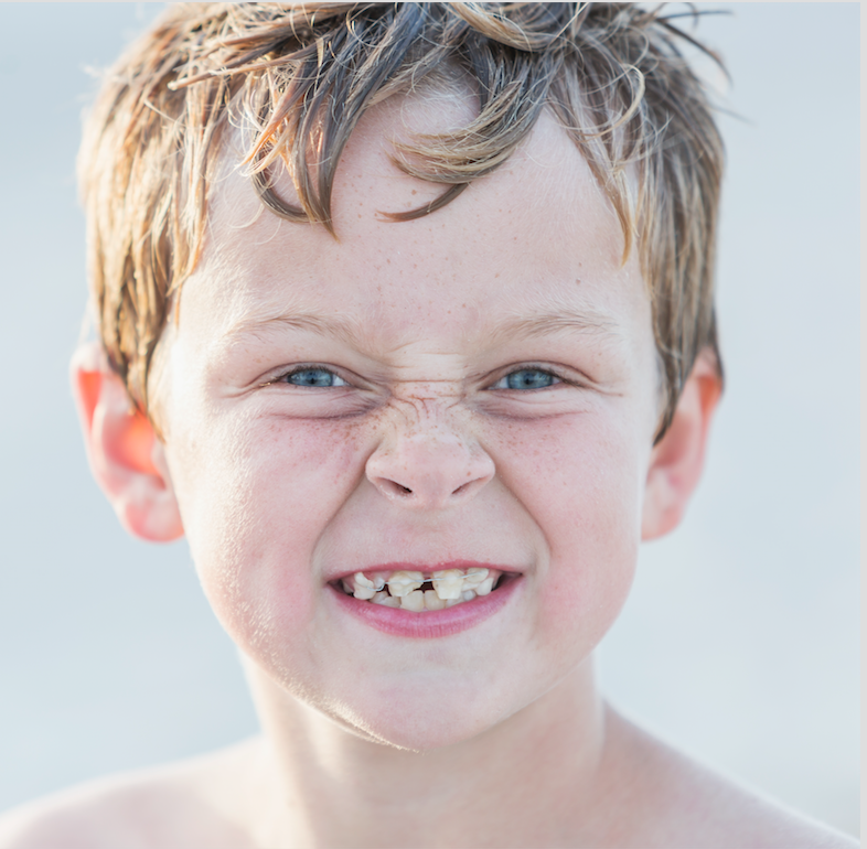 LISTEN: Are crooked teeth preventable?