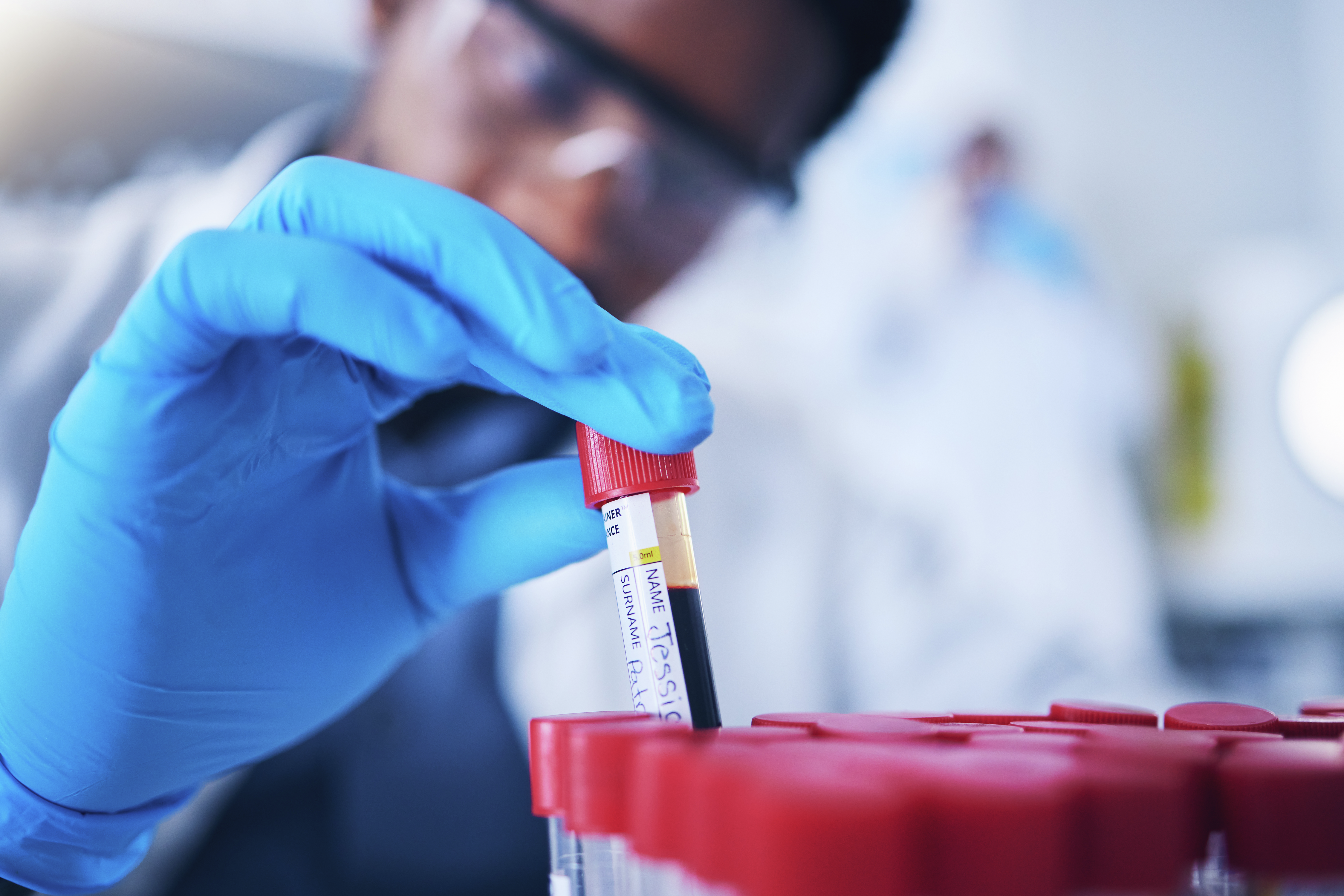 ON THE RECORD: FDA approves blood test that screens for colon cancer