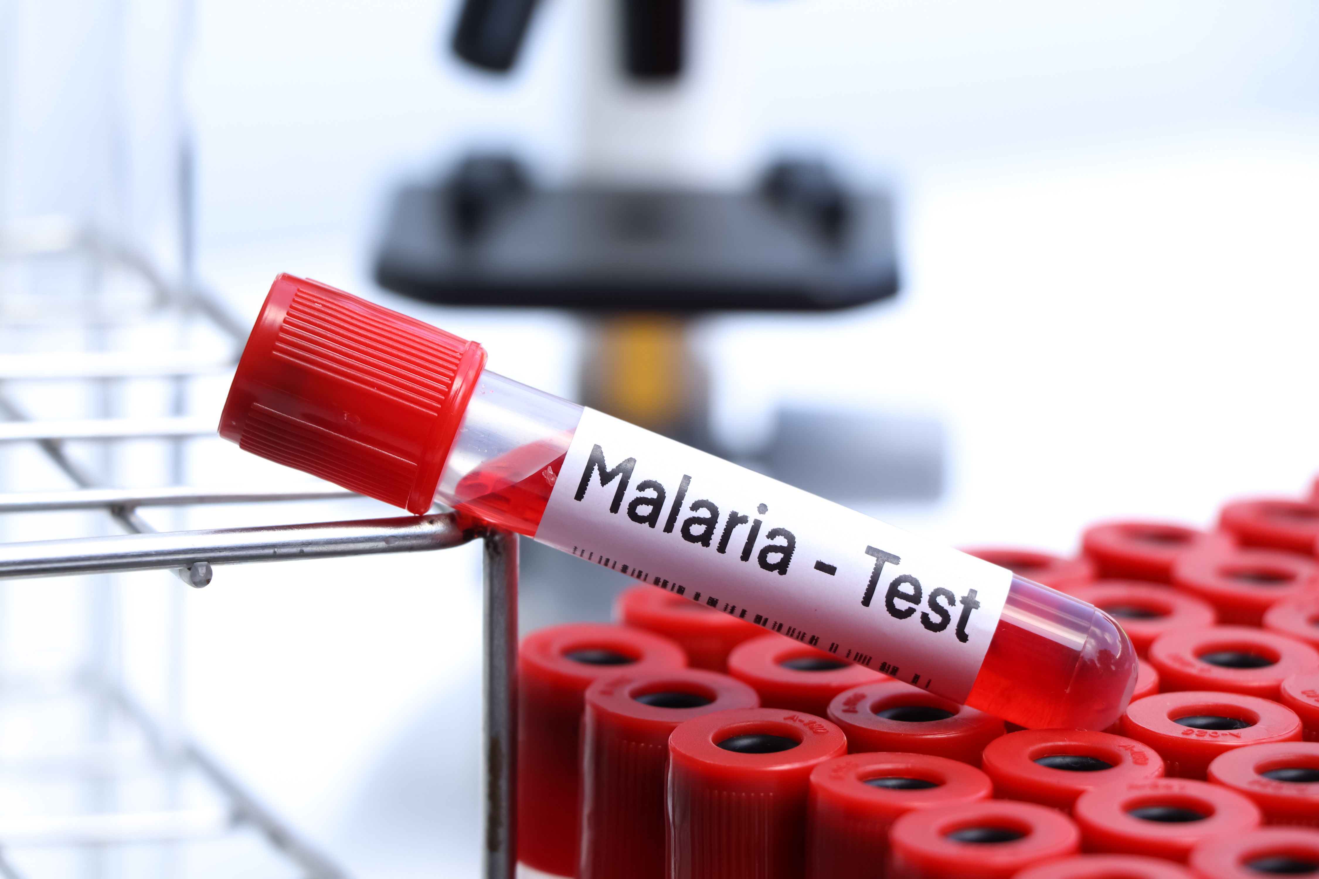 Malaria returns to the U.S.