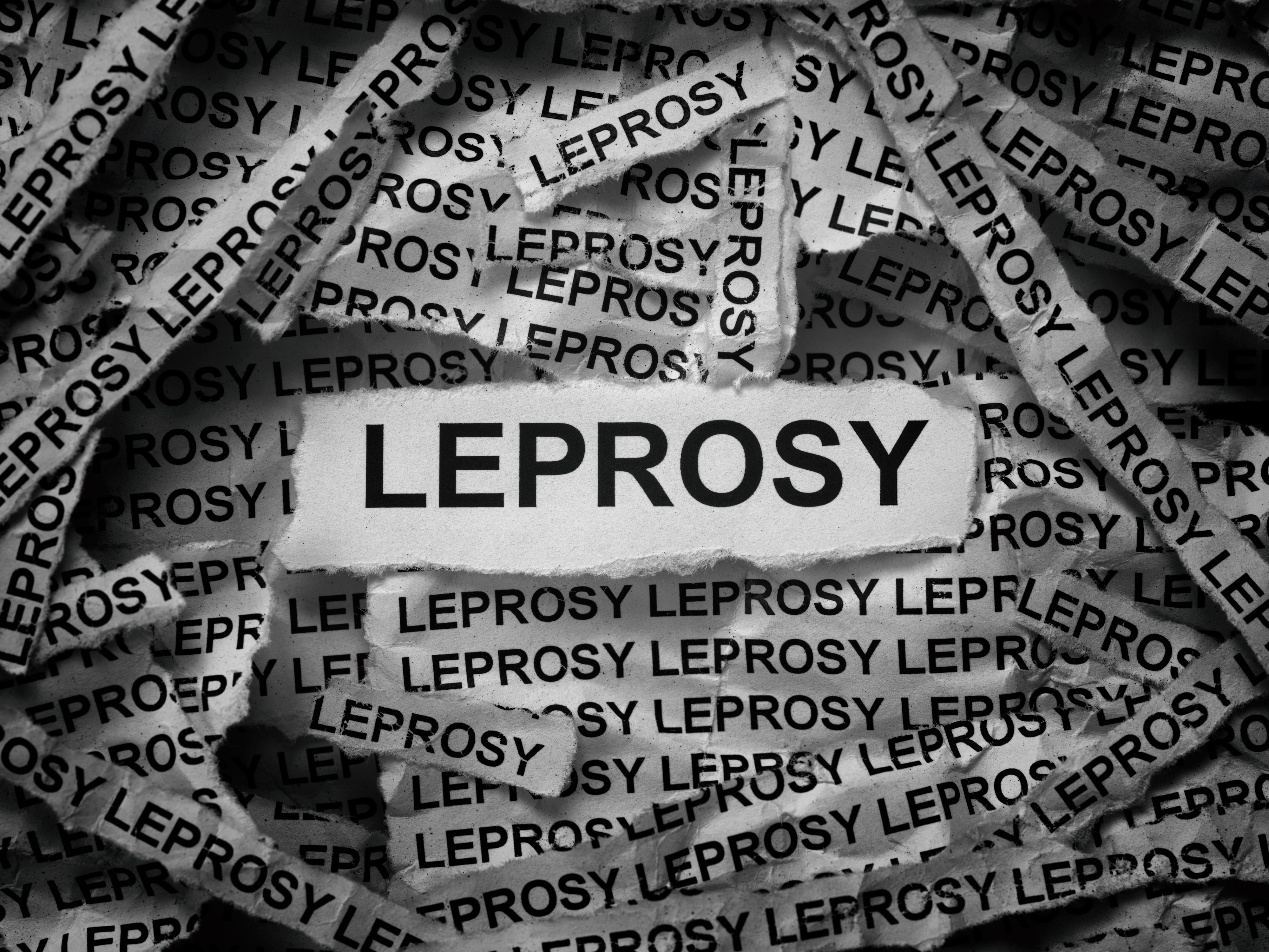 Leprosy cases on the rise in Florida