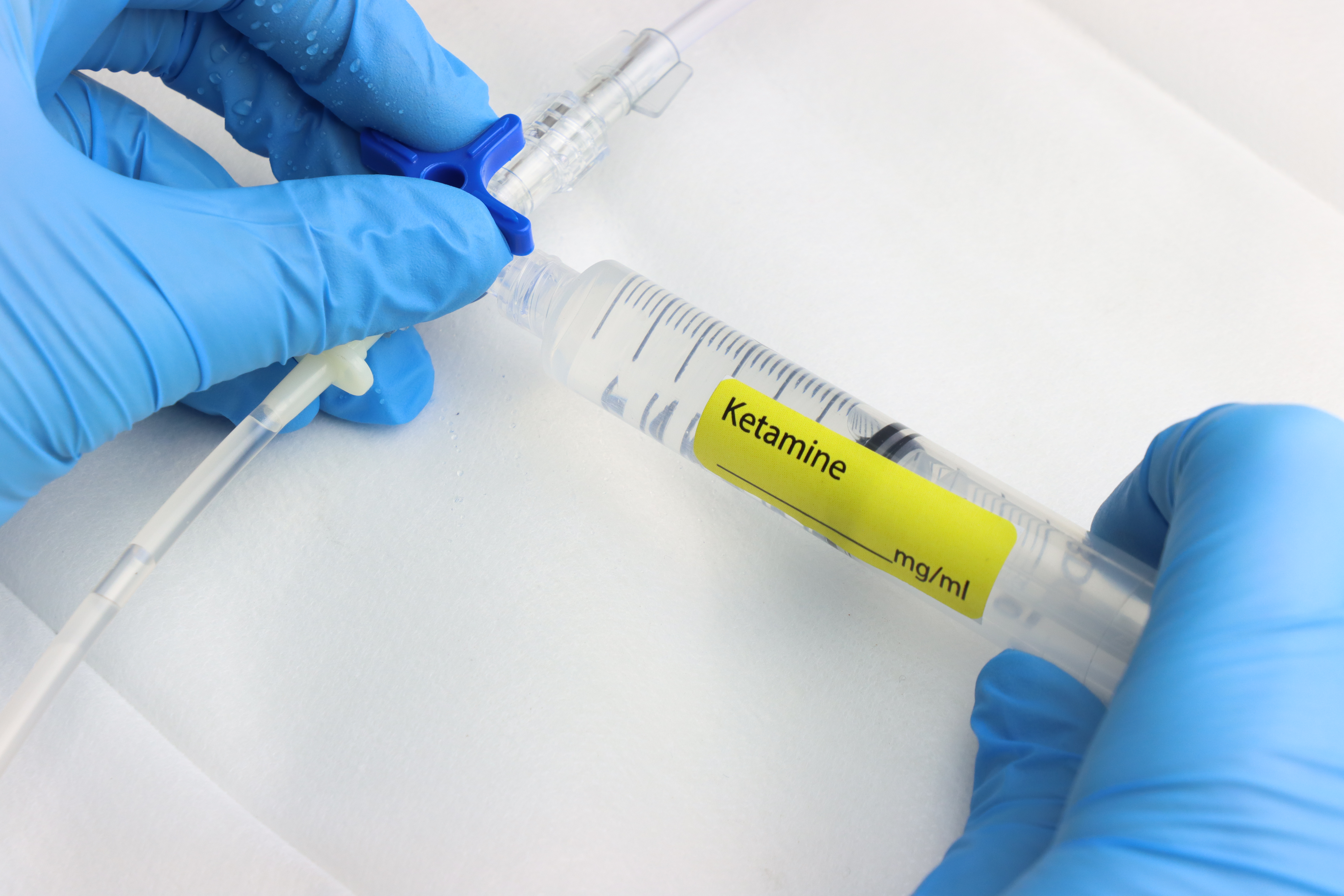 Ketamine: are the risks worth the rewards? A doctor weighs in