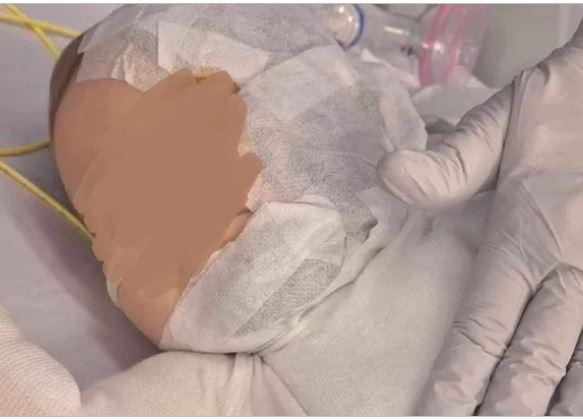 $40,0000+ raised for Brisbane baby burn victim