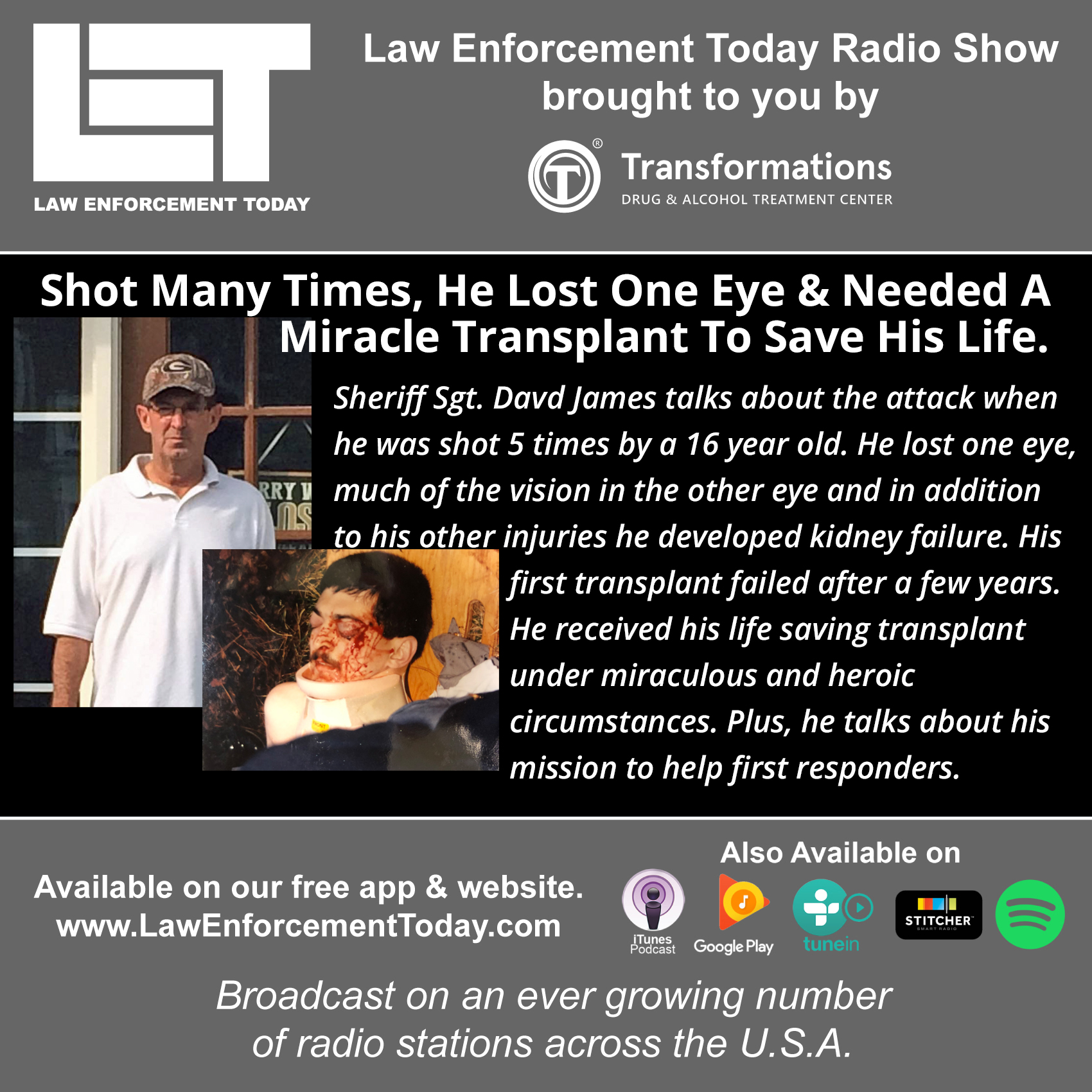 Deputy Sheriff Shot, Lost An Eye And Needed A Miracle Transplant To Save His Life.