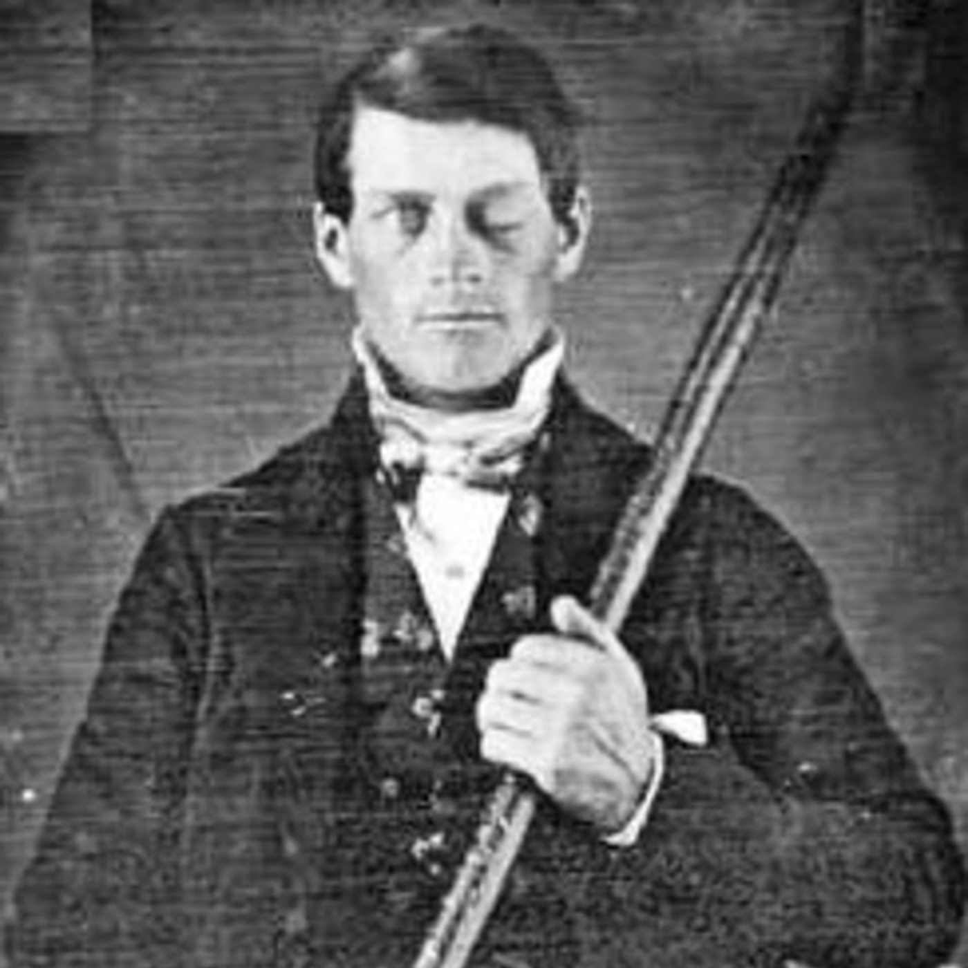 Phineas Gage