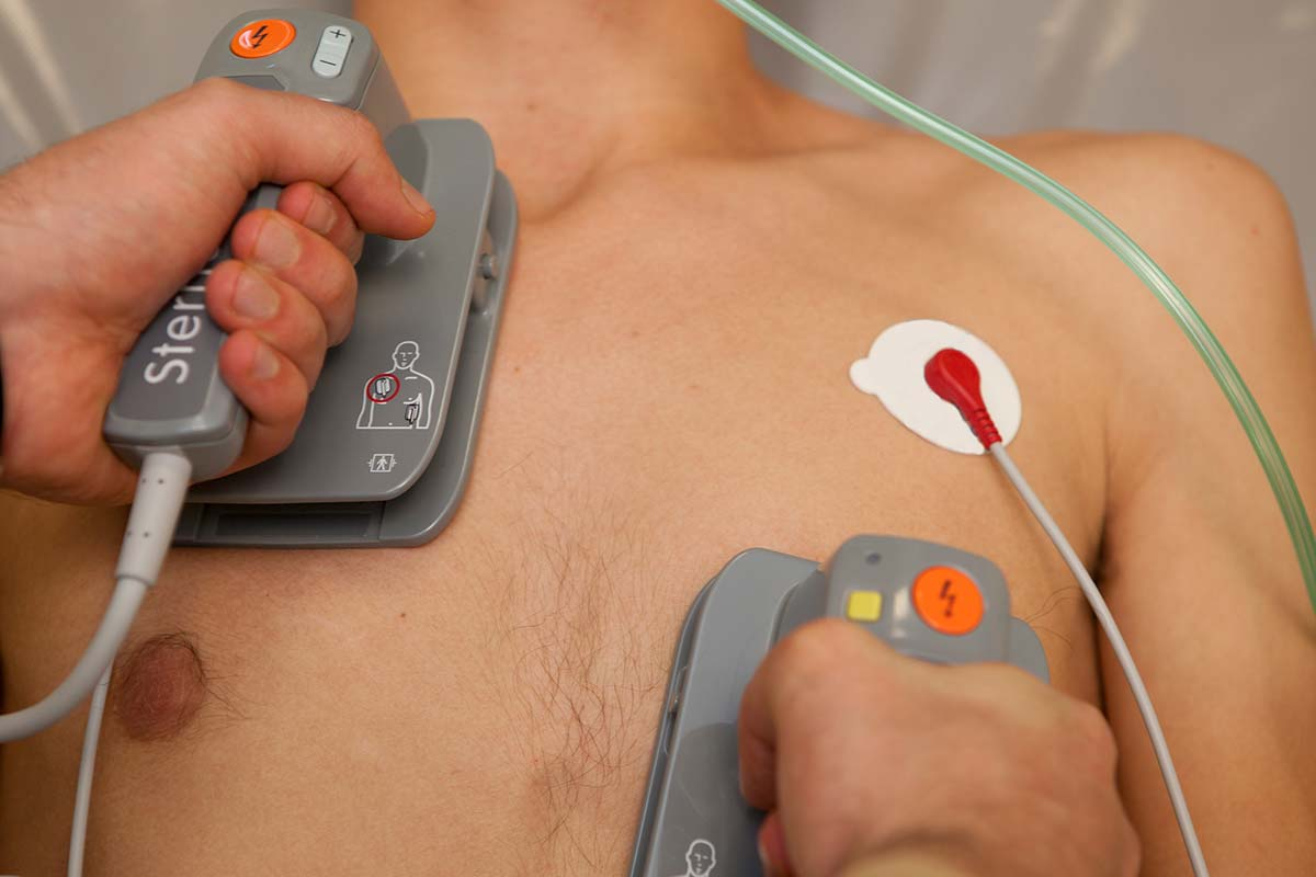 Paramedic shocked while using new defibrillation technique being trialled in Victoria