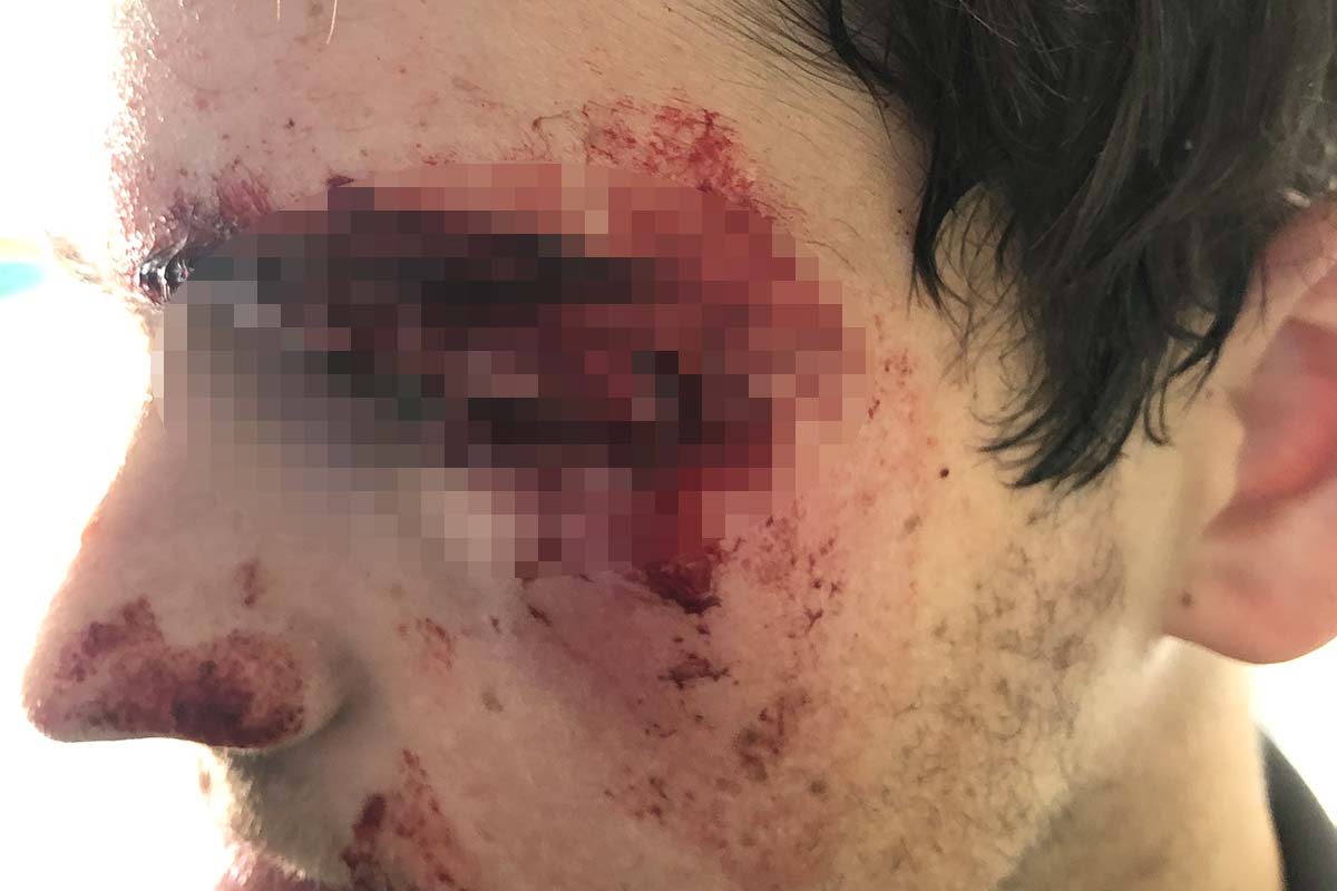 Greenskeeper struck in the eye by golf ball in Melbourne's south-east