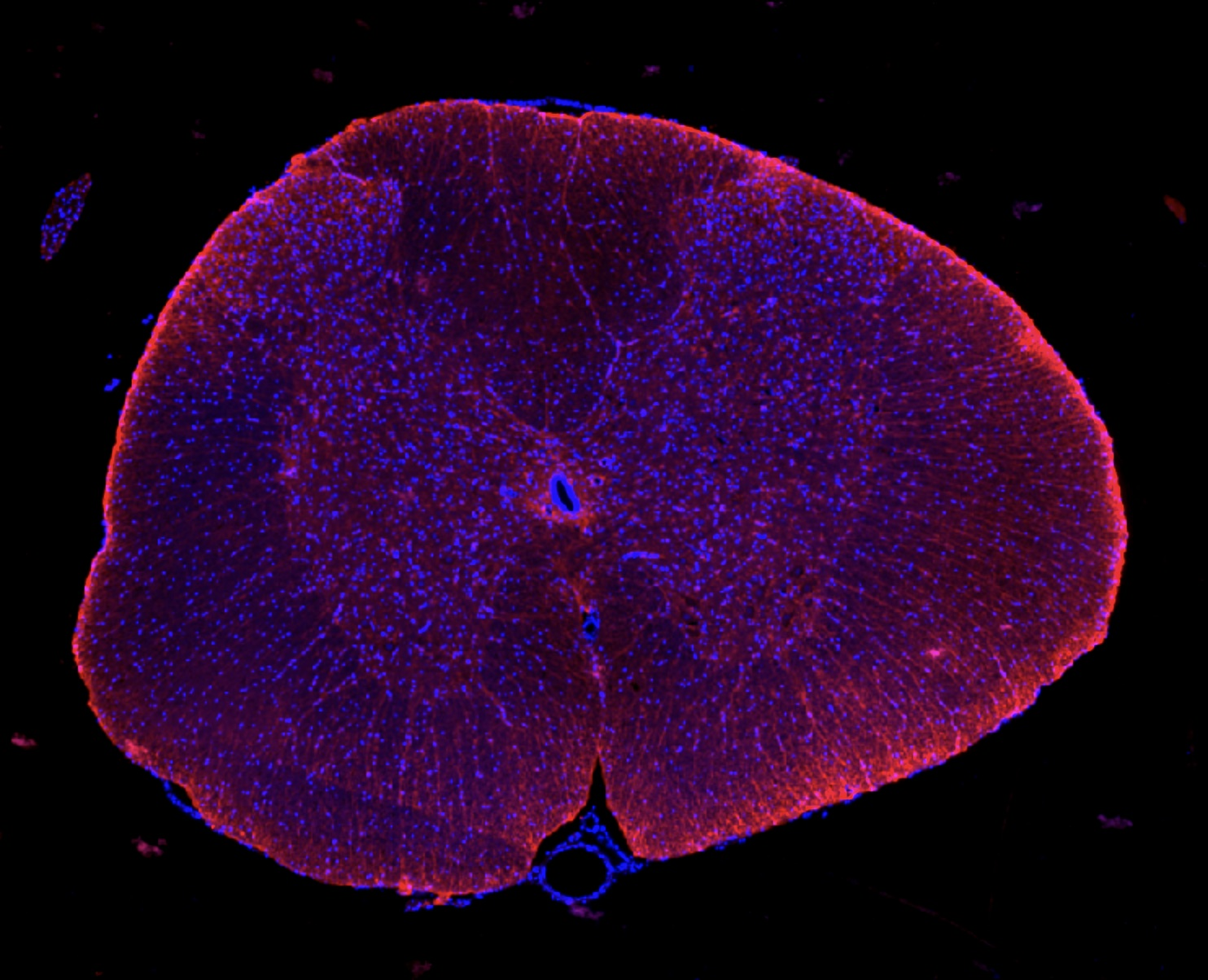 Clinical Trials and Research on Spinal Cord Injury