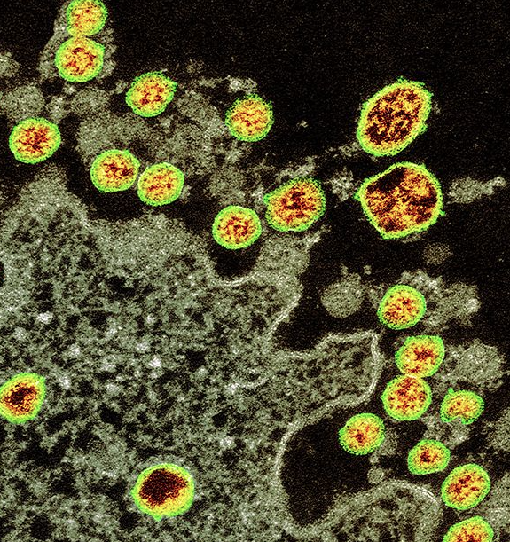 LISTEN: CORONAVIRUS UPDATE: (07.27.20) Chapman reports evidence of slowing spread of coronavirus