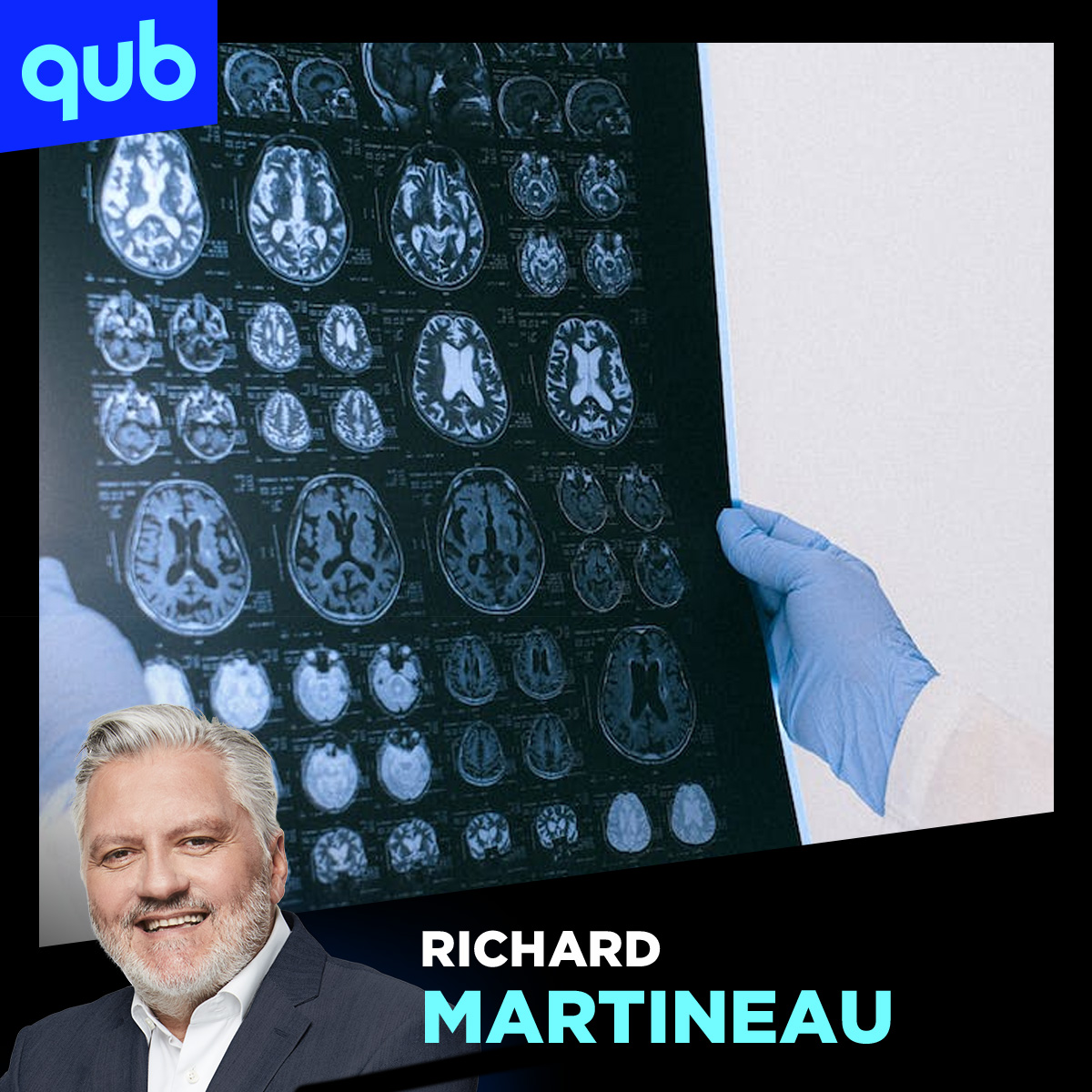 Alzheimer : Richard Martineau à coeur ouvert sur une expérience difficile