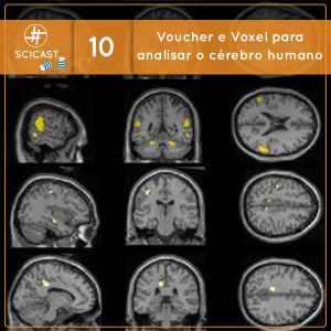 Voucher e Voxel para analisar o cérebro humano (Ciência Sem Fio #10)
